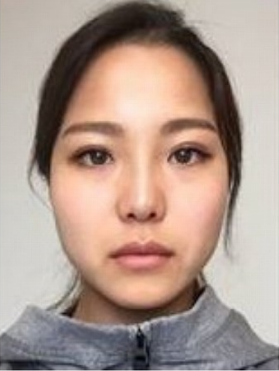 高梨沙羅は化粧とベンツ・ゲレンデのせいで成績が下がり